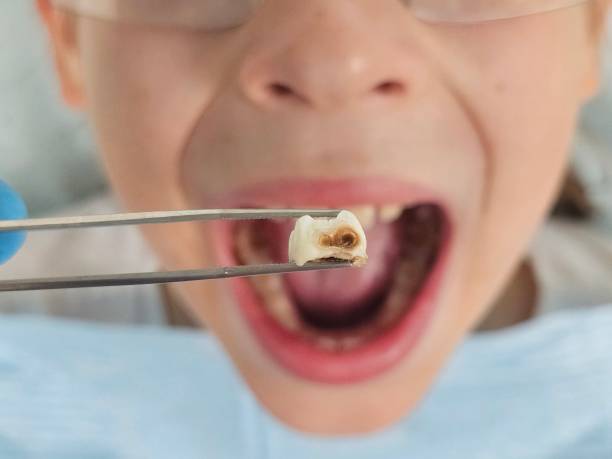 Best Emergency Root Canal Therapy in Andover, KS